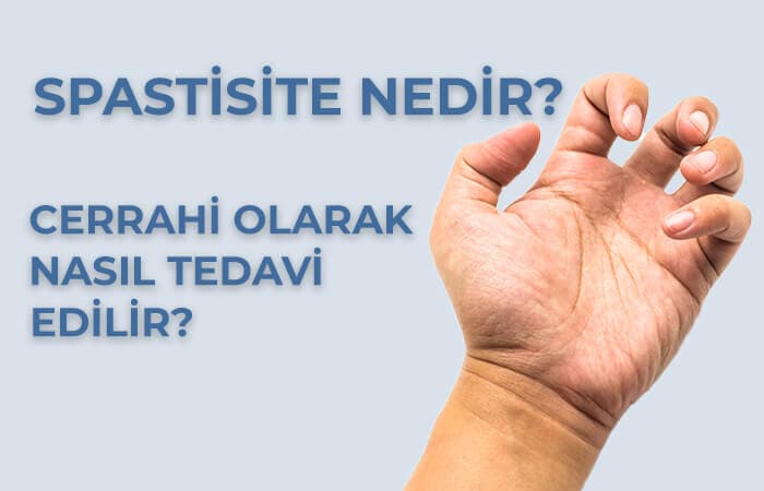 Spastisite Nedir?